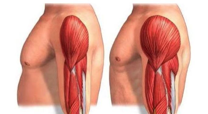 Imagen de hipertrofia muscular.