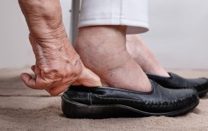 Trucos para evitar la retención de líquidos