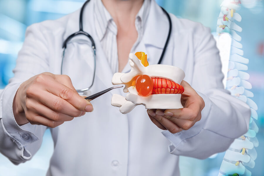 Los diferentes tratamientos quirúrgicos de la hernia discal