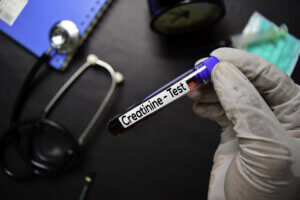 ¿Cuál es la importancia de la creatinina?