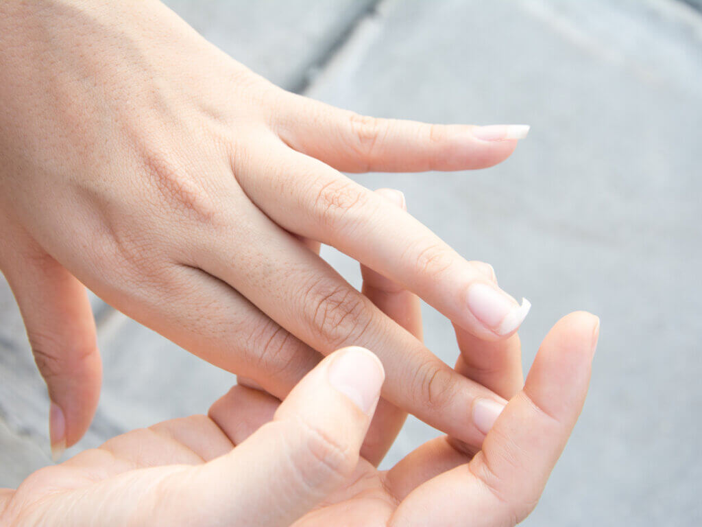 Una uña rota puede ser también señal de una carencia de hierro.