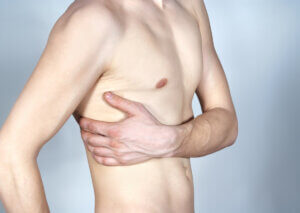 Las fracturas costales por estrés en el ejercicio