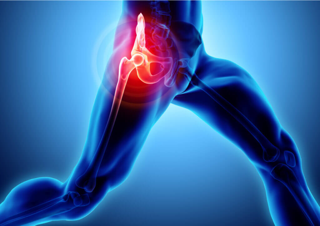 El trocánter es el hueso que sobresale a la altura de la cadera.