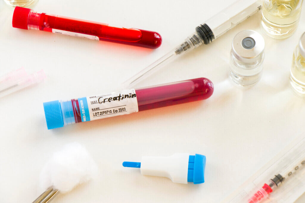 La prueba de creatinina se realiza cuando hay ciertos síntomas.